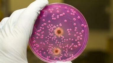 Pathological discharge in men when it is excited